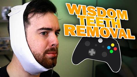 Can I Play Video Games After Wisdom Teeth Removal? Exploring the Intersection of Recovery and Entertainment